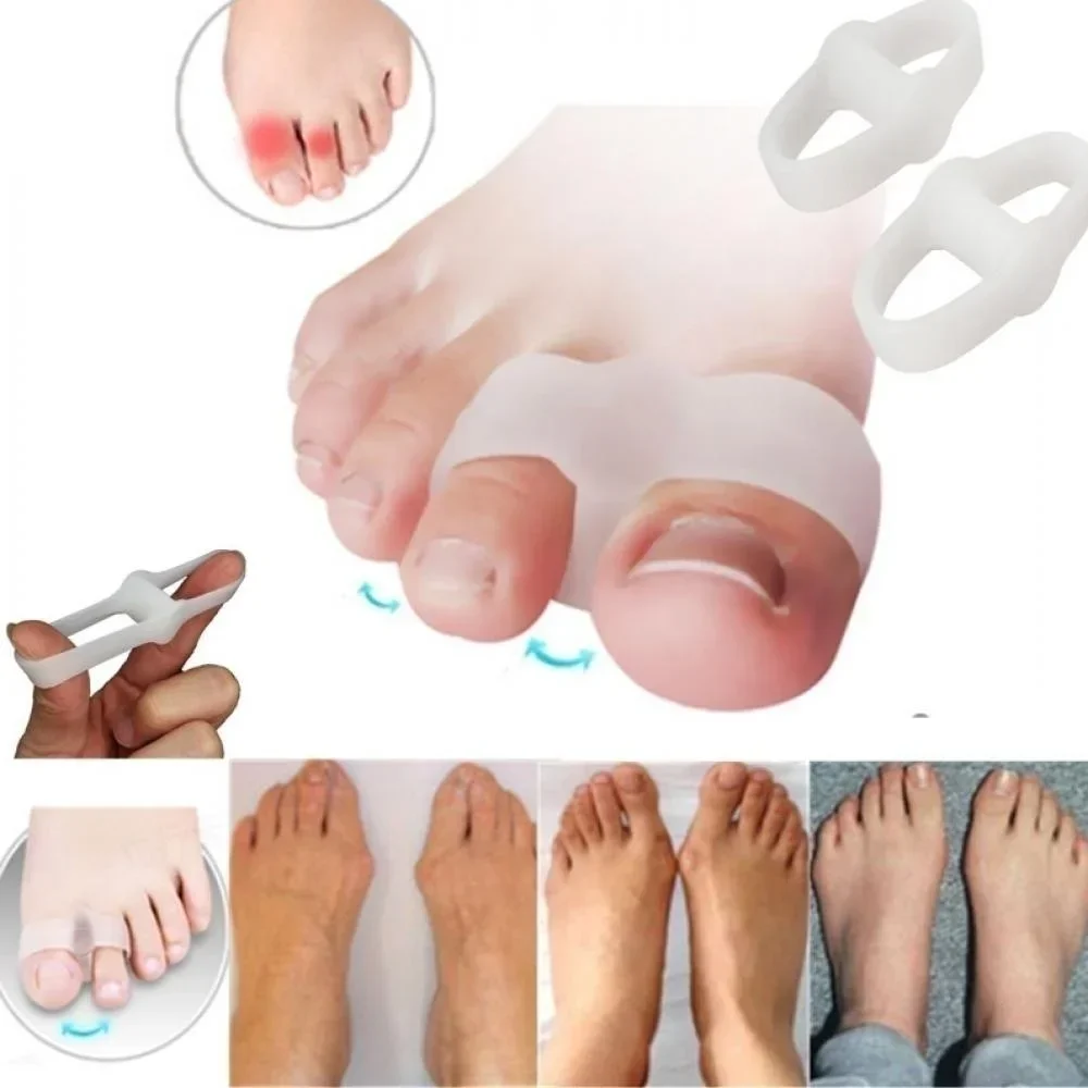 2 หลุม Bunion Corrector บรรเทา - Correction Fluid White บทวิจารณ์และราคา