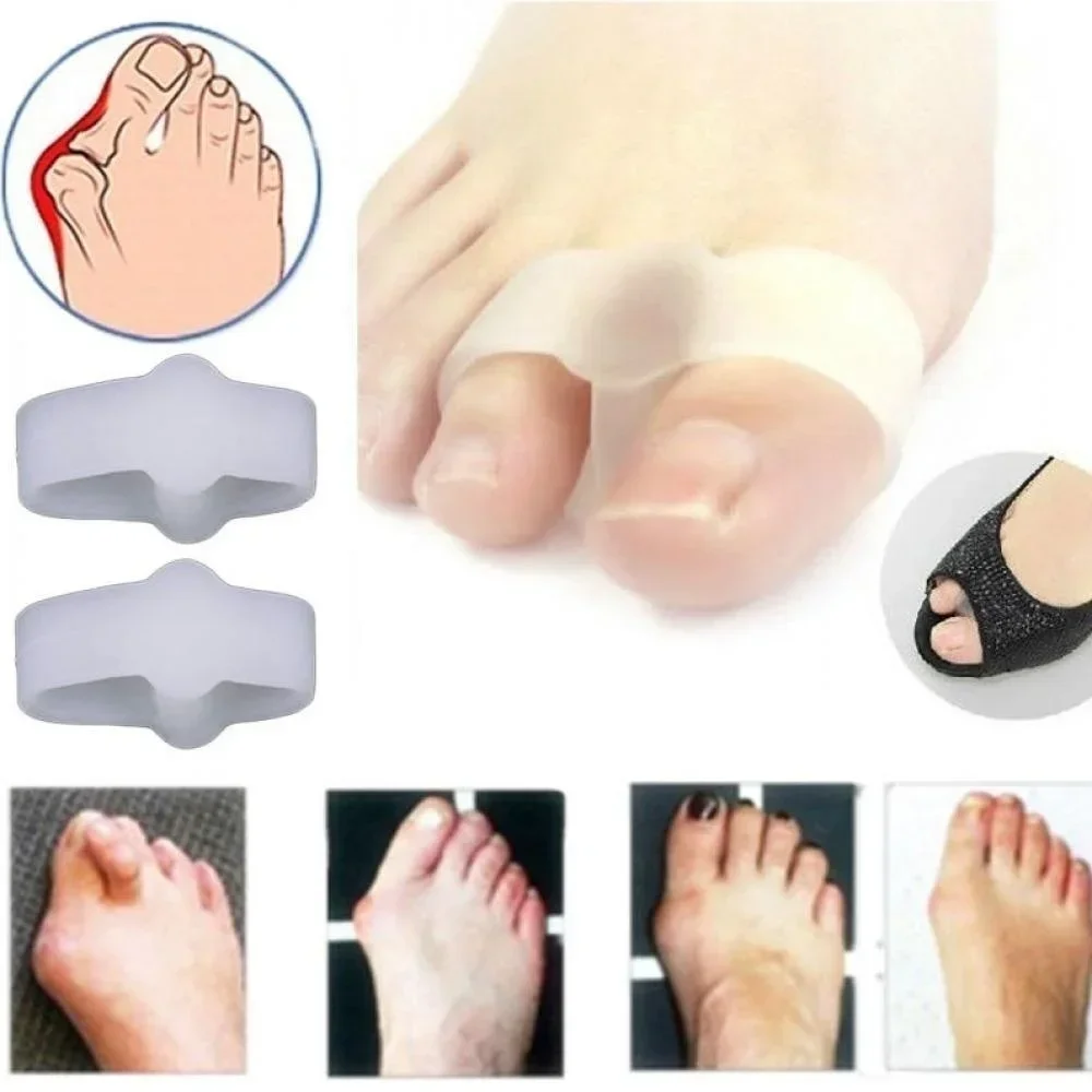 2 หลุม Bunion Corrector บรรเทา - Correction Fluid White บทวิจารณ์และราคา